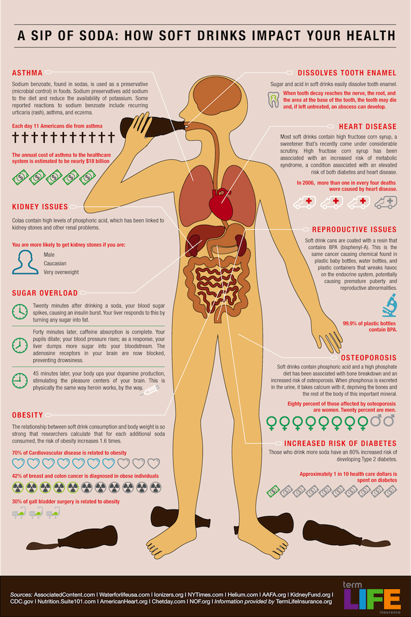 soda-infographic